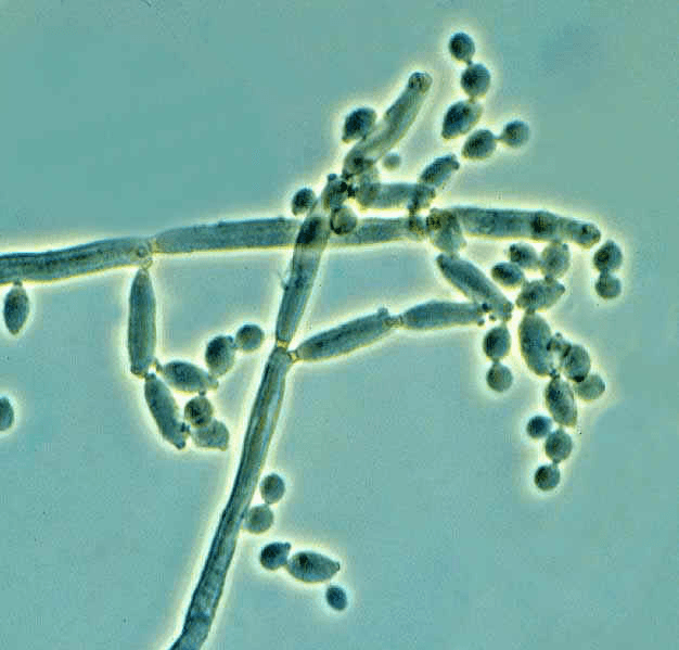 cladosporium-elimina-el-moho